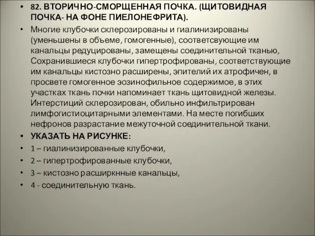 82. ВТОРИЧНО-СМОРЩЕННАЯ ПОЧКА. (ЩИТОВИДНАЯ ПОЧКА- НА ФОНЕ ПИЕЛОНЕФРИТА). Многие клубочки склерозированы