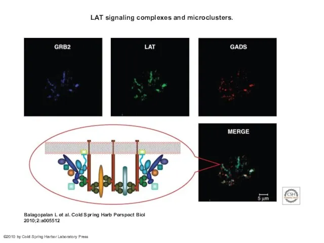 LAT signaling complexes and microclusters. Balagopalan L et al. Cold Spring