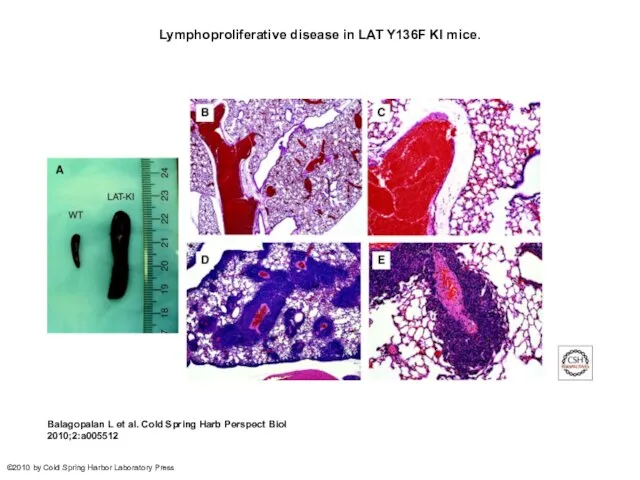 Lymphoproliferative disease in LAT Y136F KI mice. Balagopalan L et al.