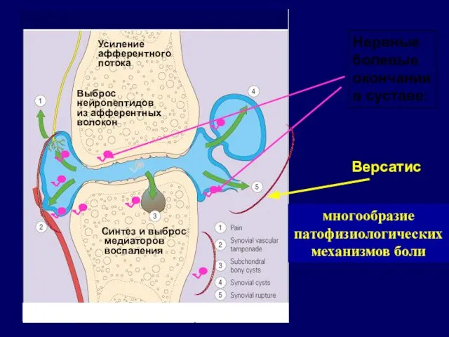 Нервные болевые окончания в суставе: Синтез и выброс медиаторов воспаления Выброс