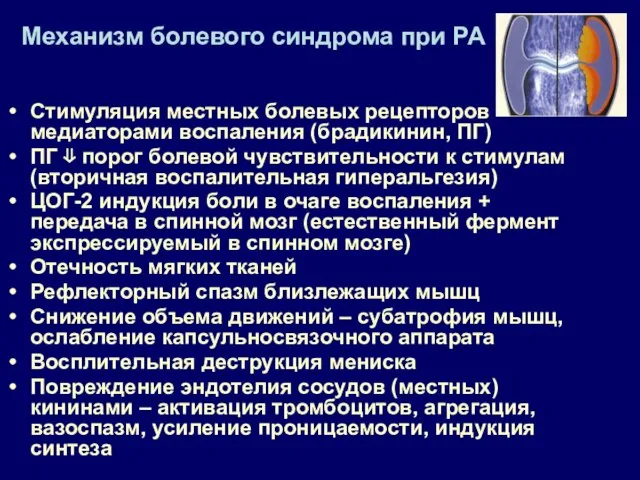 Механизм болевого синдрома при РА Стимуляция местных болевых рецепторов медиаторами воспаления