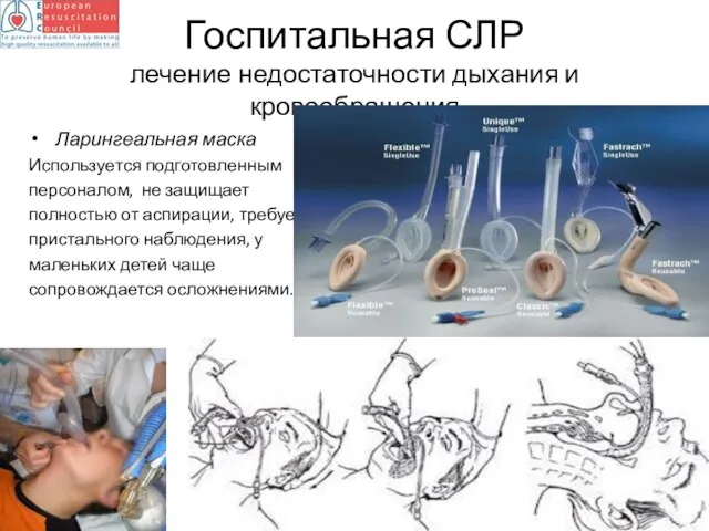 Госпитальная СЛР лечение недостаточности дыхания и кровообращения Ларингеальная маска Используется подготовленным