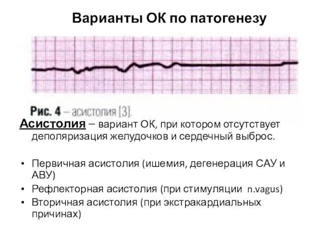 Асистолия – вариант ОК, при котором отсутствует деполяризация желудочков и сердечный