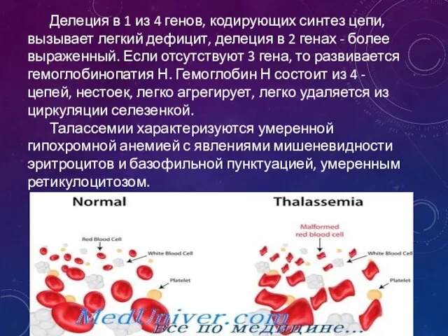 Делеция в 1 из 4 генов, кодирующих синтез цепи, вызывает легкий