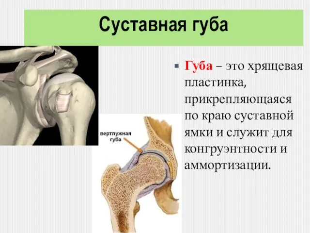 Суставная губа Губа – это хрящевая пластинка, прикрепляющаяся по краю суставной