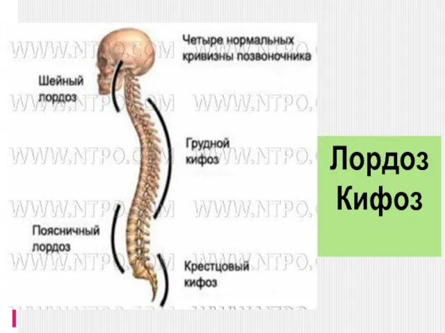 Лордоз Кифоз