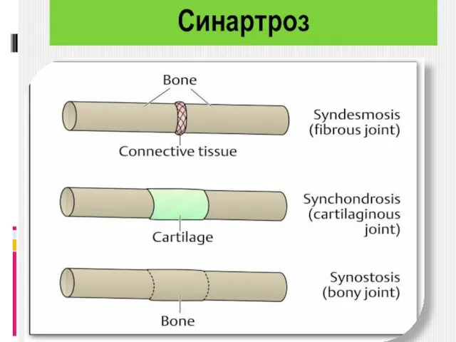 Синартроз