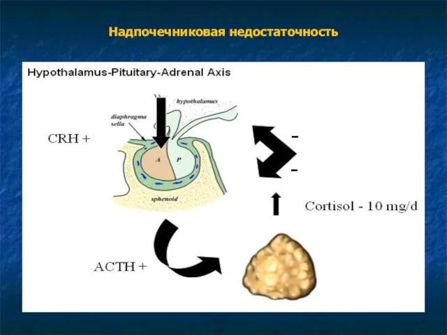 Надпочечниковая недостаточность