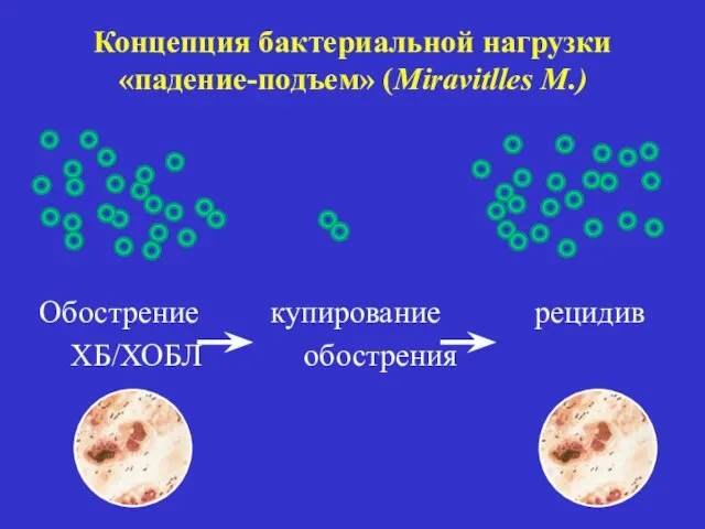 Концепция бактериальной нагрузки «падение-подъем» (Miravitlles M.) Обострение купирование рецидив ХБ/ХОБЛ обострения