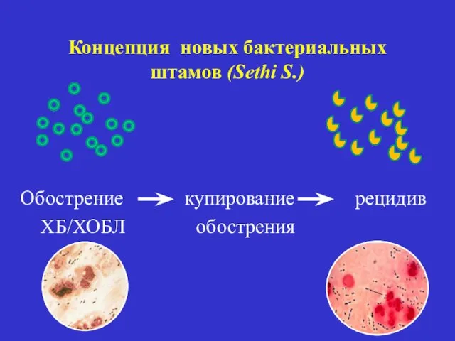 Концепция новых бактериальных штамов (Sethi S.) Обострение купирование рецидив ХБ/ХОБЛ обострения