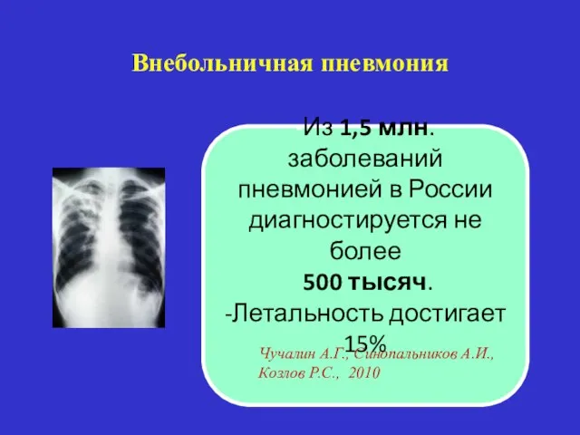 Внебольничная пневмония -Из 1,5 млн. заболеваний пневмонией в России диагностируется не