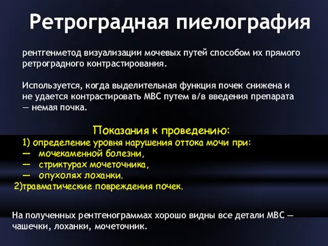 Ретроградная пиелография рентгенметод визуализации мочевых путей способом их прямого ретроградного контрастирования.