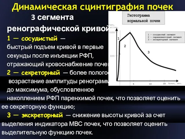 Динамическая сцинтиграфия почек 3 сегмента ренографической кривой: 1 — сосудистый —