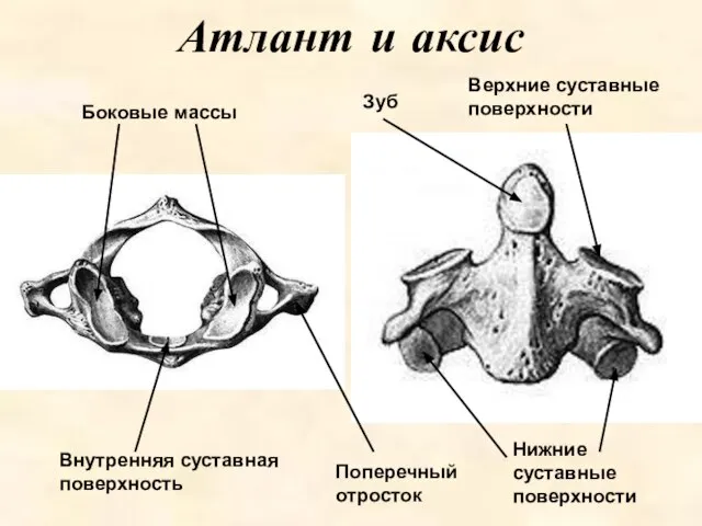 Атлант и аксис Боковые массы Внутренняя суставная поверхность Зуб Поперечный отросток