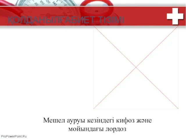 ҚОЛДАНЫЛҒАБИЕТ ТІЗІМІ Мешел ауруы кезіндегі кифоз және мойындағы лордоз