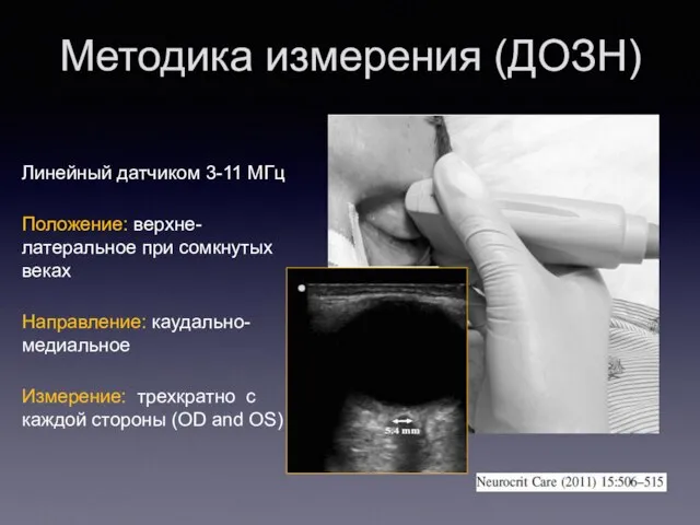 Методика измерения (ДОЗН) Линейный датчиком 3-11 МГц Положение: верхне-латеральное при сомкнутых