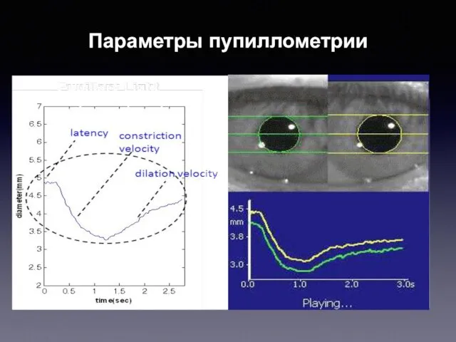 Параметры пупиллометрии