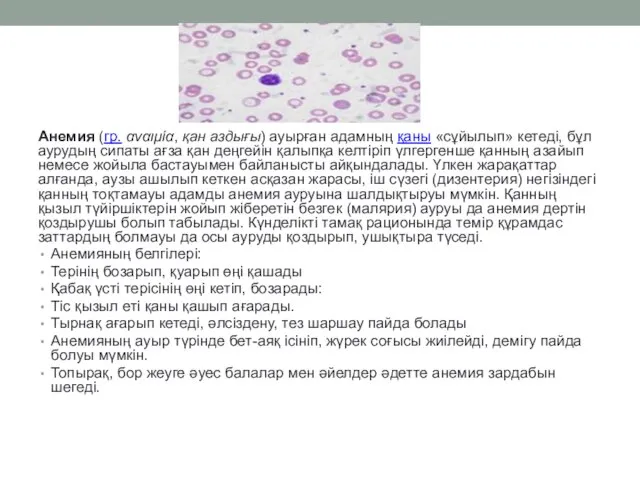 Анемия (гр. αναιμία, қан аздығы) ауырған адамның қаны «сұйылып» кетеді, бұл