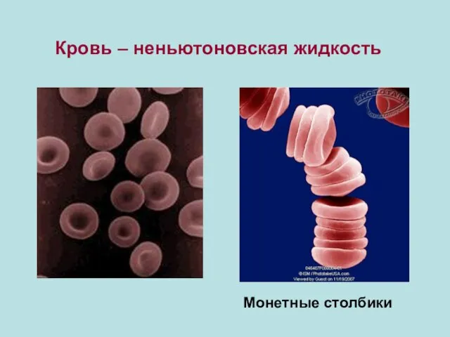 Кровь – неньютоновская жидкость Монетные столбики