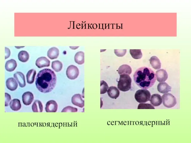 Лейкоциты палочкоядерный сегментоядерный