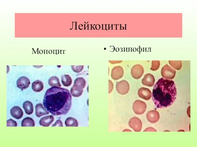 Лейкоциты Эозинофил Моноцит