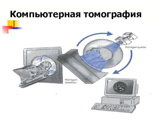 Компьютерная томография