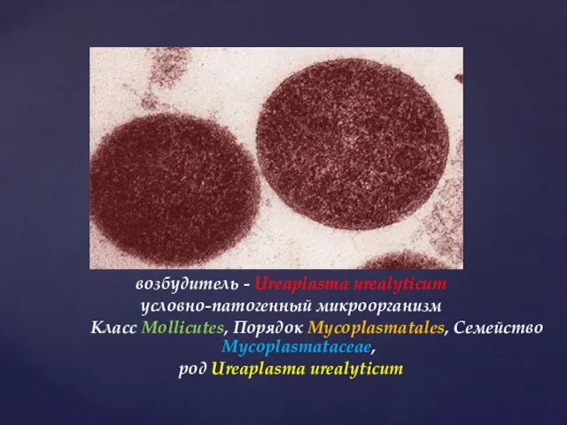 возбудитель - Ureaplasma urealyticum условно-патогенный микроорганизм Класс Mollicutes, Порядок Mycoplasmatales, Семейство Mycoplasmataceae, род Ureaplasma urealyticum