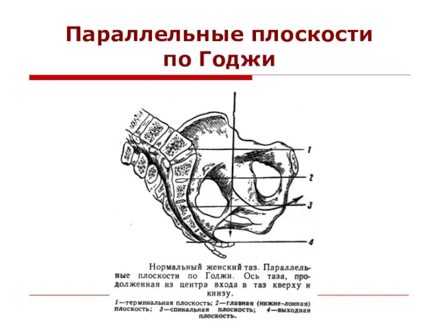 Параллельные плоскости по Годжи