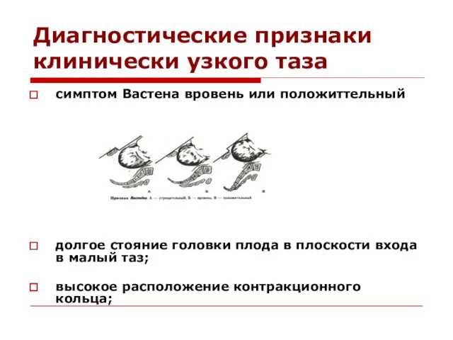 Диагностические признаки клинически узкого таза симптом Вастена вровень или положиттельный долгое