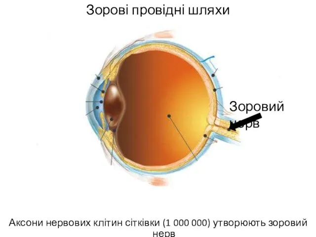 Зорові провідні шляхи Аксони нервових клітин сітківки (1 000 000) утворюють зоровий нерв Зоровий нерв