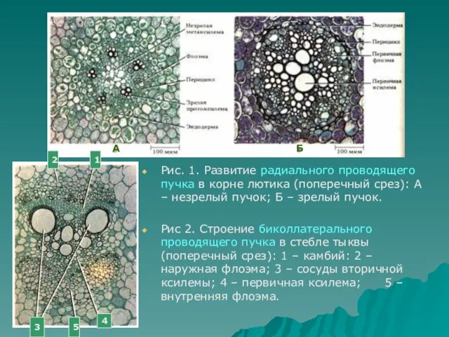 Рис. 1. Развитие радиального проводящего пучка в корне лютика (поперечный срез):