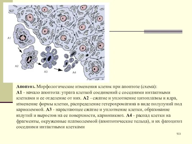 Апоптоз. Морфологические изменения клеток при апоптозе (схема): А1 - начало апоптоза: