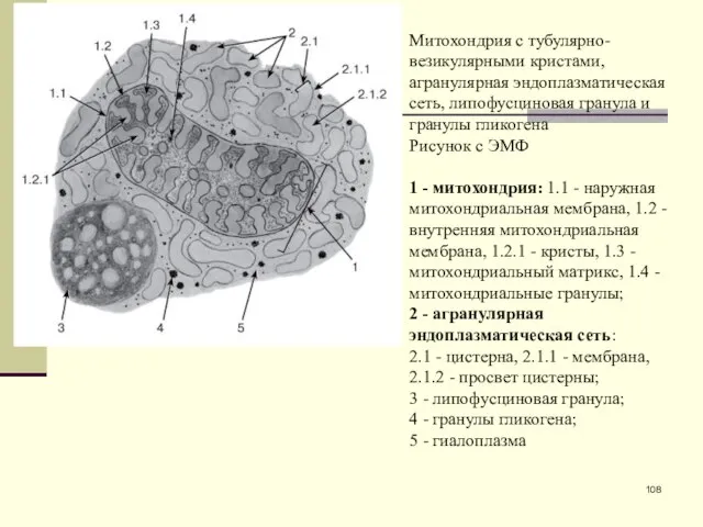 Митохондрия с тубулярно-везикулярными кристами, агранулярная эндоплазматическая сеть, липофусциновая гранула и гранулы