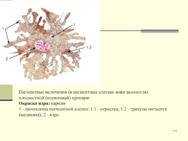 Пигментные включения (в пигментных клетках кожи аксолотля): плоскостной (пленочный) препарат Окраска