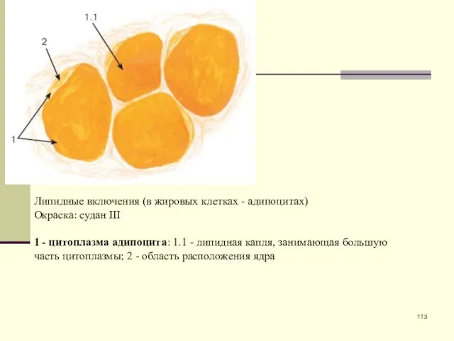 Липидные включения (в жировых клетках - адипоцитах) Окраска: судан III 1