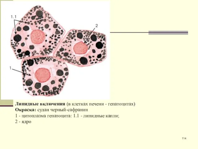 Липидные включения (в клетках печени - гепатоцитах) Окраска: судан черный-сафранин 1