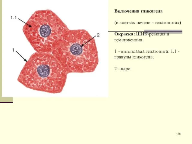 Включения гликогена (в клетках печени - гепатоцитах) Окраска: ШИК-реакция и гематоксилин