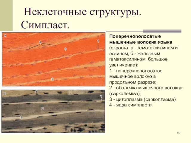 Неклеточные структуры. Симпласт. Поперечнополосатые мышечные волокна языка (окраска: а - гематоксилином