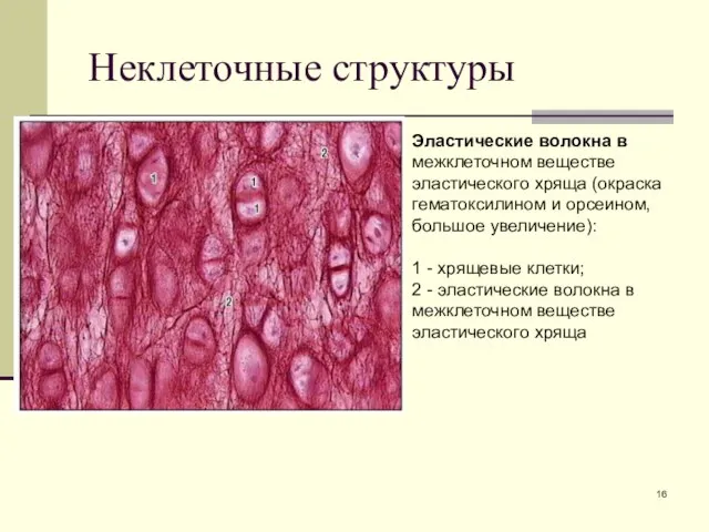 Неклеточные структуры Эластические волокна в межклеточном веществе эластического хряща (окраска гематоксилином