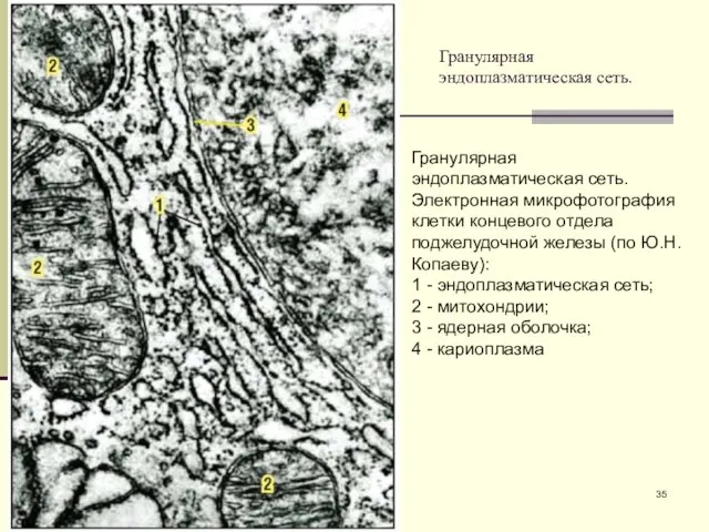 Гранулярная эндоплазматическая сеть. Гранулярная эндоплазматическая сеть. Электронная микрофотография клетки концевого отдела