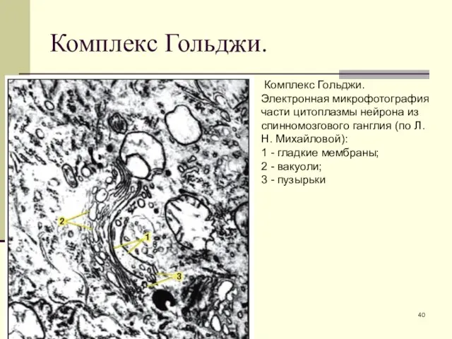 Комплекс Гольджи. Комплекс Гольджи. Электронная микрофотография части цитоплазмы нейрона из спинномозгового