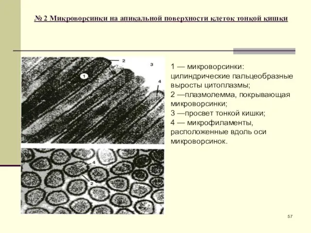 № 2 Микроворсинки на апикальной поверхности клеток тонкой кишки 1 —