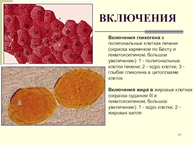 ВКЛЮЧЕНИЯ Включения гликогена в полигональных клетках печени (окраска кармином по Бесту