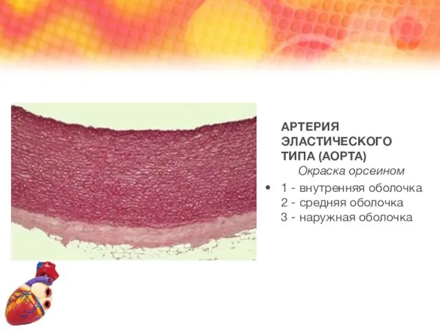 АРТЕРИЯ ЭЛАСТИЧЕСКОГО ТИПА (АОРТА) Окраска орсеином 1 - внутренняя оболочка 2