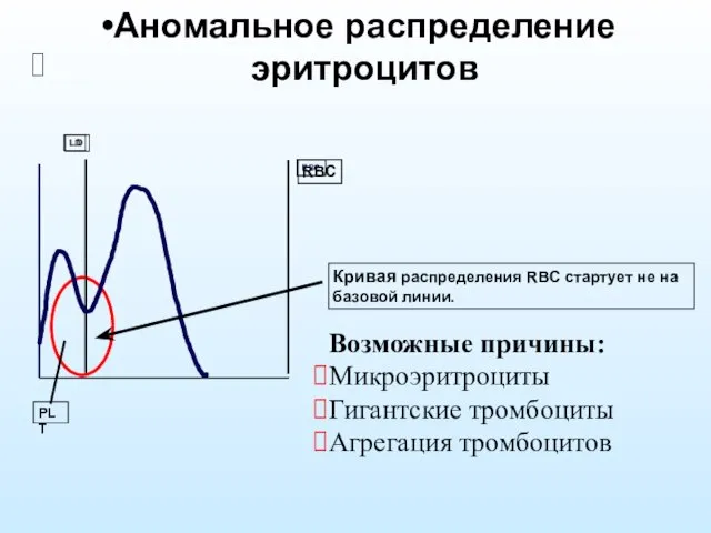 Аномальное распределение эритроцитов Возможные причины: Микроэритроциты Гигантские тромбоциты Агрегация тромбоцитов