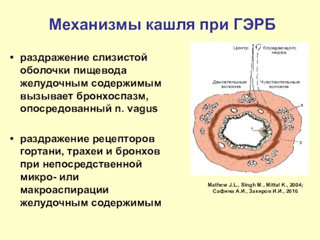 Механизмы кашля при ГЭРБ раздражение слизистой оболочки пищевода желудочным содержимым вызывает