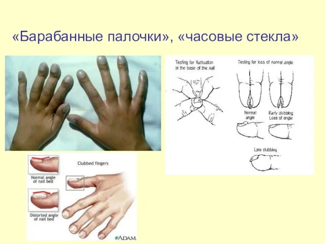 «Барабанные палочки», «часовые стекла»