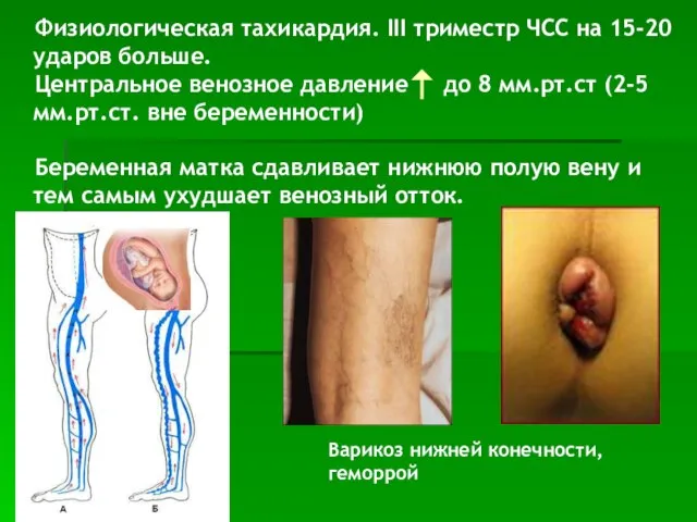 Физиологическая тахикардия. III триместр ЧСС на 15-20 ударов больше. Центральное венозное
