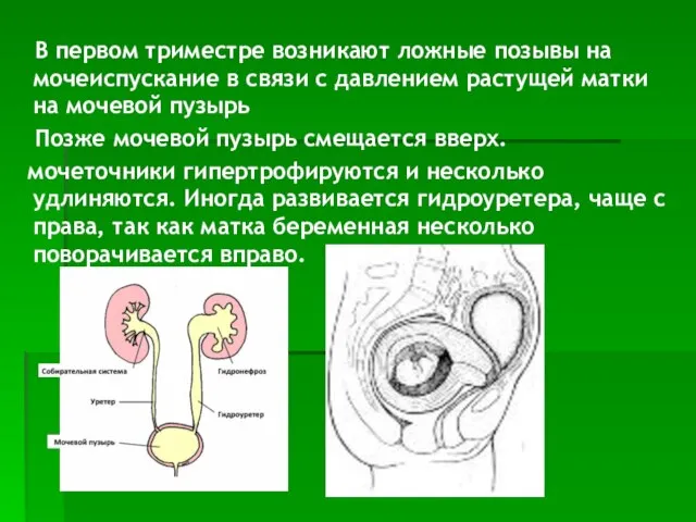 В первом триместре возникают ложные позывы на мочеиспускание в связи с