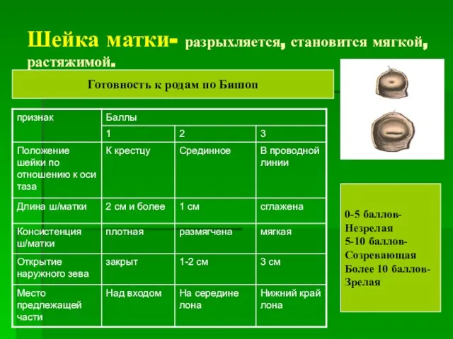 Шейка матки- разрыхляется, становится мягкой, растяжимой. Готовность к родам по Бишоп